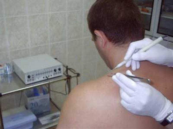 В течение двух дней в Горловке можно пройти обследование на наличие рака кожи на ранней стадии