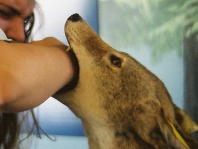 2-летняя горловчанка, искусанная собакой, - в удовлетворительном состоянии. Малышка не нуждалась в операции