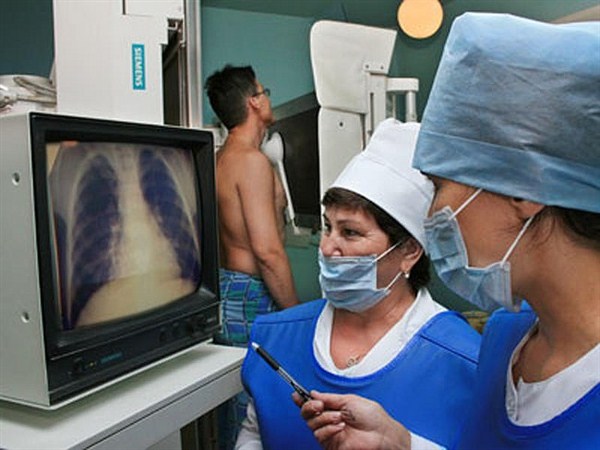Ко Всемирному дню борьбы с туберкулезом в Горловке состоится акция «Будь ответственным – пройди флюорографию»