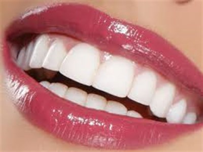 Сколько стоят виниры на зубы и есть ли возможность установить их недорого