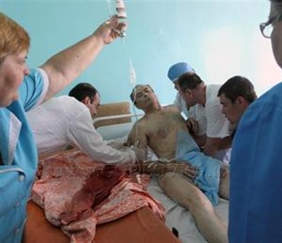 Раненых горловчан транспортируют в районную больницу Артемовска. Острая нужда в аппаратах внутренней фиксации (ВИДЕО)