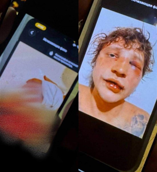 Катування і вбивство на Балі сина бізнесмена з Дніпра Ігоря Комарова: одним з підозрюваних є уродженець Горлівки 