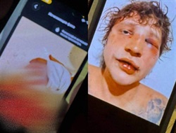 Катування і вбивство на Балі сина бізнесмена з Дніпра Ігоря Комарова: одним з підозрюваних є уродженець Горлівки 