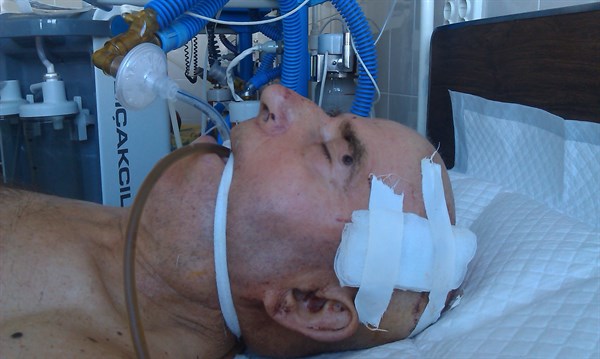 Возле станции Майорская обнаружен мужчина с черепно-мозговой травмой. Милиция не может установить его личность (ФОТО)